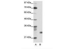 Image no. 1 for anti-Sin3A-Associated Protein, 30kDa (SAP30) (N-Term) antibody (ABIN202078)