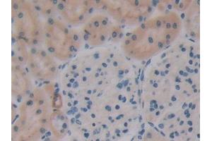 Detection of OPN in Rat Kidney Tissue using Polyclonal Antibody to Osteopontin (OPN) (Osteopontin antibody  (AA 17-317))