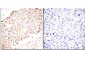 Immunohistochemistry (IHC) image for anti-SUMO1/sentrin Specific Peptidase 1 (SENP1) (N-Term) antibody (ABIN1848841) (SENP1 antibody  (N-Term))