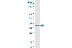 Immunoprecipitation of TRIM72 transfected lysate using anti-TRIM72 MaxPab rabbit polyclonal antibody and Protein A Magnetic Bead , and immunoblotted with TRIM72 purified MaxPab mouse polyclonal antibody (B01P) . (TRIM72 antibody  (AA 1-269))