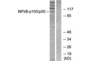 Western blot analysis of extracts from HeLa cells, using NF-kappaB p105/p50 (Ab-893) Antibody. (NFKB1 antibody  (AA 860-909))