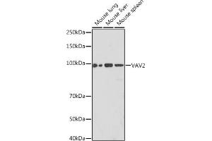 Western blot analysis of extracts of various cell lines, using V Rabbit mAb (ABIN7271304) at 1:1000 dilution. (VAV2 antibody)
