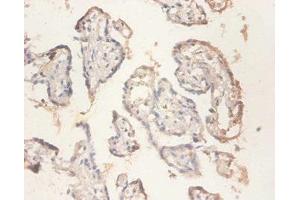 Immunohistochemistry of paraffin-embedded human placenta tissue using ABIN7142480 at dilution of 1:100 (RPS11 antibody  (AA 2-158))
