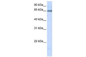 Western Blotting (WB) image for anti-DNA Cross-Link Repair 1C (DCLRE1C) antibody (ABIN2459466)