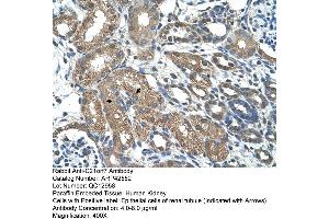 Human kidney (MAP3K7CL antibody  (C-Term))