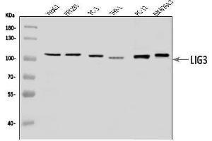 Western blot analysis of DNA Ligase III/LIG3 using anti-DNA Ligase III/LIG3 antibody (ABIN7601167).