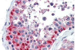 Human Testis (formalin-fixed, paraffin-embedded) stained with GSC antibody ABIN462175 followed by biotinylated goat anti-rabbit IgG secondary antibody ABIN481713, alkaline phosphatase-streptavidin and chromogen. (GSC antibody  (AA 35-84))