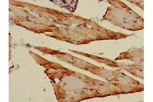Immunohistochemistry of paraffin-embedded human skeletal muscle tissue using ABIN7143343 at dilution of 1:100 (Adenylate Kinase 1 antibody  (AA 1-194))