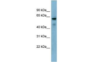 WB Suggested Anti-KIAA1627 Antibody Titration:  0. (KIAA1627 antibody  (N-Term))