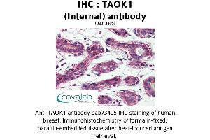 Image no. 1 for anti-TAO Kinase 1 (TAOK1) (Internal Region) antibody (ABIN1739900) (TAO Kinase 1 (TAOK1) (Internal Region) antibody)
