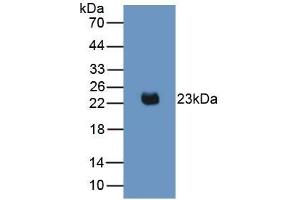Detection of Recombinant IL2, Mouse using Monoclonal Antibody to Interleukin 2 (IL2) (IL-2 antibody  (AA 10-169))