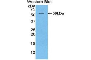 Western Blotting (WB) image for anti-ATPase, H+/K+ Exchanging, alpha Polypeptide (ATP4A) (AA 786-1014) antibody (ABIN1858098) (ATP4A antibody  (AA 786-1014))
