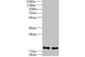 Western blot All lanes: PPP3R1 antibody at 1 μg/mL Lane 1: K562 whole cell lysate Lane 2: Hela whole cell lysate Secondary Goat polyclonal to rabbit IgG at 1/10000 dilution Predicted band size: 20 kDa Observed band size: 20 kDa (PPP3R1 antibody  (AA 11-170))