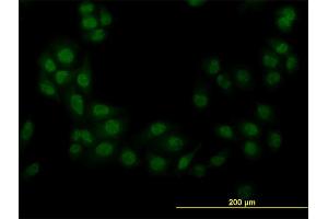 Immunofluorescence of monoclonal antibody to STK38 on HeLa cell. (STK38 antibody  (AA 365-465))