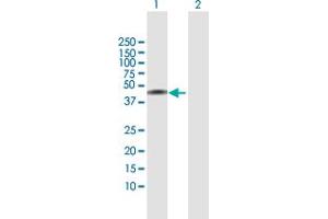 Western Blot analysis of NSDHL expression in transfected 293T cell line by NSDHL MaxPab polyclonal antibody. (NSDHL antibody  (AA 1-373))