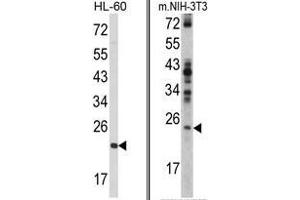 (LEFT) Western blot analysis of RAN Antibody (N-term) in HL-60 cell line lysates (35ug/lane). (RAN antibody  (N-Term))