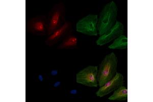 ABIN6259439 and ABIN6276269 staining  cells by IF/ICC.
