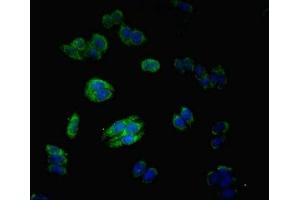 Immunofluorescent analysis of HepG2 cells using ABIN7159049 at dilution of 1:100 and Alexa Fluor 488-congugated AffiniPure Goat Anti-Rabbit IgG(H+L) (Matrilin 3 antibody  (AA 277-486))