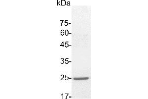 SDS-PAGE (SDS) image for Tumor Necrosis Factor (Ligand) Superfamily, Member 9 (TNFSF9) (Active) protein (His tag) (ABIN7884604)