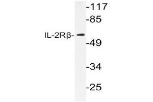 Western blot (WB) analysis of IL-2Rbeta antibody in extracts from RAW264.