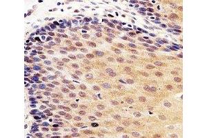Immunohistochemistry (IHC) image for anti-Tumor Protein P53 (TP53) (AA 364-393) antibody (ABIN3029395)