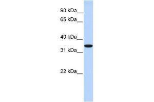 WB Suggested Anti-MARCH1 Antibody Titration:  0. (MARCH1 antibody  (N-Term))