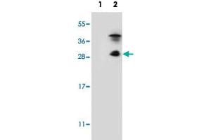Western blot analysis of KLK7 (arrow) using KLK7 polyclonal antibody . (Kallikrein 7 antibody  (C-Term))
