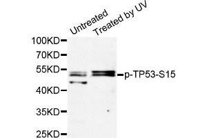Western Blotting (WB) image for anti-Tumor Protein P53 (TP53) (pSer15) antibody (ABIN1870674) (p53 antibody  (pSer15))