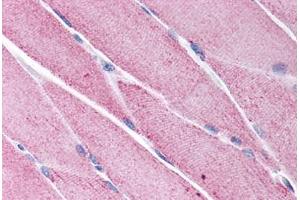 Human Skeletal Muscle (formalin-fixed, paraffin-embedded) stained with KCNG1 antibody ABIN214781 at 5 ug/ml followed by biotinylated goat anti-rabbit IgG secondary antibody ABIN481713, alkaline phosphatase-streptavidin and chromogen. (KCNG1 antibody  (N-Term))