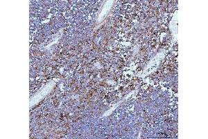 IHC analysis of IL22 using anti-IL22 antibody (ABIN5518929).