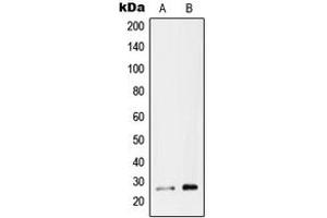 Western blot analysis of RAB26 expression in MCF7 (A), U87MG (B) whole cell lysates. (RAB26 antibody  (C-Term))