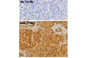 Immunohistochemistry (IHC) image for anti-STIP1 Homology and U-Box Containing Protein 1 (STUB1) antibody (ABIN6254206)