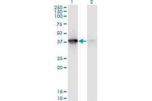 Western Blot analysis of MAPKAPK3 expression in transfected 293T cell line by MAPKAPK3 monoclonal antibody (M01), clone 3F4. (MAPKAP Kinase 3 antibody  (AA 272-382))