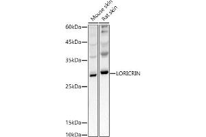 Western blot analysis of extracts of various cell lines, using LORICRIN antibody (ABIN7268295) at 1:1000 dilution. (LOR antibody)