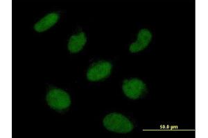 Immunofluorescence of  purified  MaxPab antibody to RNF113A on HeLa cell. (RNF113A antibody  (AA 1-343))
