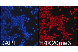 Immunofluorescence analysis of 293T cell using H4K20me3 antibody. (Histone H4 antibody  (3meLys20))