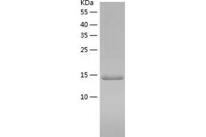 Western Blotting (WB) image for Eukaryotic Translation Initiation Factor 1A, X-Linked (EIF1AX) (AA 1-144) protein (His tag) (ABIN7286223) (EIF1AX Protein (AA 1-144) (His tag))