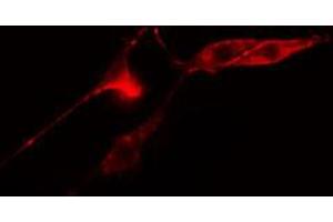 ABIN6274748 staining COLO205 cells by IF/ICC. (RPS12 antibody  (C-Term))