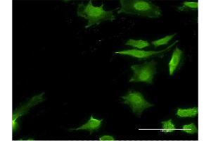 Immunofluorescence of monoclonal antibody to STIP1 on HeLa cell. (STIP1 antibody  (AA 1-543))