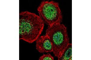 Fluorescent confocal image of A431 cell stained with LEF1 Antibody (N-term) (ABIN655987 and ABIN2845371).