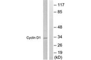 Western blot analysis of extracts from Jurkat cells, treated with EGF 200ng/ml 30', using Cyclin D1 (Ab-286) Antibody. (Cyclin D1 antibody  (AA 246-295))