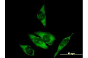 Immunofluorescence of purified MaxPab antibody to RPL29 on HeLa cell. (RPL29 antibody  (AA 1-159))