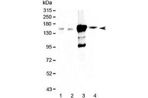 Western blot testing of 1) rat kidney, 2) mouse kidney, 3) human 293T and 4) human HK-2 lysate with Periaxin antibody at 0.