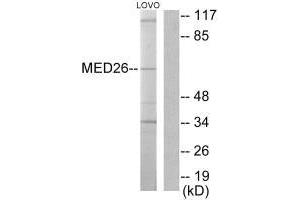 Western blot analysis of extracts from LOVO cells, using MED26 antibody. (MED26 antibody  (N-Term))