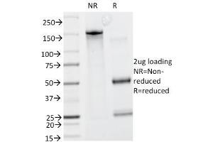 SDS-PAGE Analysis Purified Caldesmon Mouse Monoclonal Antibody (CALD1/820). (Caldesmon antibody)