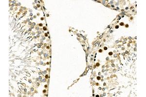 ABIN6257335 and ABIN6274168 at 1/100 staining Rat testis tissue by IHC-P. (MYF5 antibody  (N-Term))