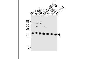 ICT1 Antibody (C-term) (ABIN1881444 and ABIN2843293) western blot analysis in Hela,Jurkat,,MDA-M,NCI-,K562,ZR-75-1 cell line lysates (35 μg/lane). (ICT1 antibody  (C-Term))