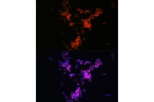 Immunofluorescence analysis of SH-SY5Y cells using CHAT Rabbit mAb (ABIN7266343) at dilution of 1:100 (40x lens). (Choline Acetyltransferase antibody)