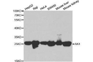 Western blot analysis of extracts of various cell lines, using AK4 antibody.
