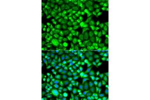 Immunofluorescence analysis of A549 cells using PSMB8 antibody. (PSMB8 antibody)